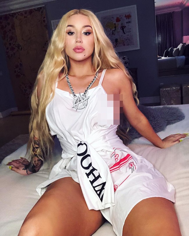 Setelah operasi memancungkan hidung dan payudara, tampaknya Iggy tak cukup puas. Sejak Juni silam, Iggy telah dirumorkan melakukan sejumlah operasi plastik dan filler di sana-sini di bagian wajahnya. Foto: Instagram (@ thenewclassic)