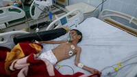 Jutaan anak di Yaman terancam mengalami kelaparan. Yaman mengalami kehancuran akibat eskalasi konflik yang meningkat pada 2015, ketika koalisi yang dipimpin Arab Saudi melakukan intervensi militer setelah kelompok pemberontak Houthi menguasai sebagian besar wilayah barat negara itu. Foto: Reuters