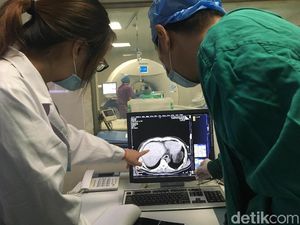 Cryosurgery untuk Kanker Banyak Diminati, Seperti Ini Cara Kerjanya