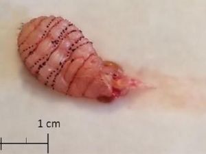 Bulan Madu Jadi Cerita Horor Gara-gara Larva Parasit