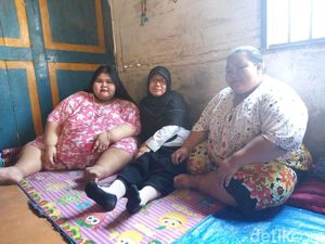 Berat Badan Gadis Berbobot 179 Kg Turun Lagi, Ini Kata Dokter
