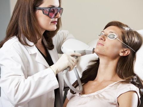 ilustrasi facial laser