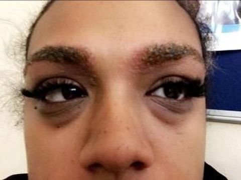 Wanita Ini Alami Hal Menyedihkan Setelah Mentato Alis 