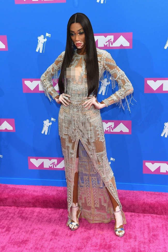 Model Winnie Harlow mengenakan gaun transparan karya Zuhair Murad di MTV Video Music Awards 2018. Ia tampil percaya diri dengan kondisi kulitnya yang mengalami vitiligo, mengenakan gaun menerawang yang dihiasi perhiasan. Foto: Getty Images