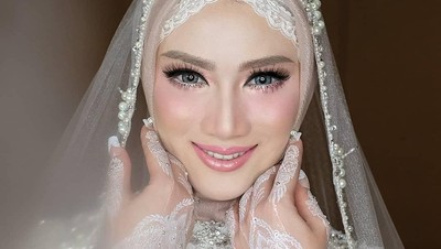 Foto: Cantiknya Melody Eks JKT 48 dari Prewedding hingga Resepsi Nikah