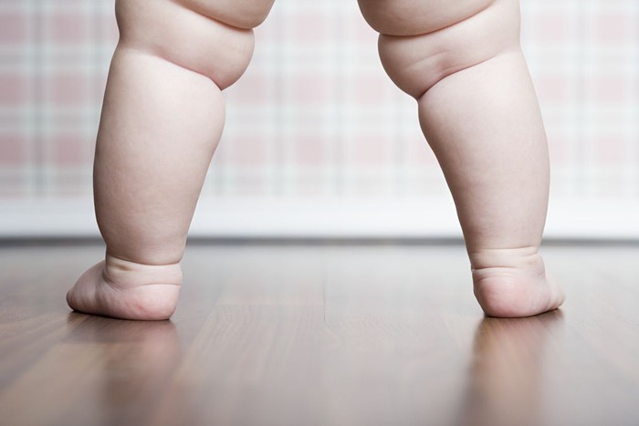 ilustrasi anak obesitas