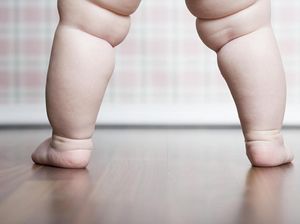 Biang Kerok Masalah Obesitas pada Anak
