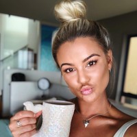 Ketika itu, Karina mengaku menjalani gaya hidup yang tidak sehat karena terpengaruh media sosial. Menjaga berat badan agar terlihat kurus di media sosial, ia pun menjaga makan dengan menghitung kalori hingga olahraga berlebih. Foto: Instagram @karinairby