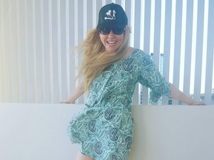 Cerita Inspiratif Wanita yang Kakinya Diamputasi dan Sukses Jadi Model