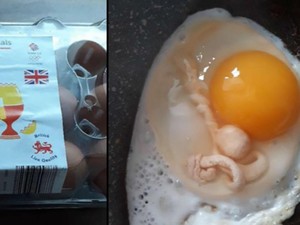 Kaget! Wanita Ini Temukan Bentuk Mirip Tali Pusar dalam Telur