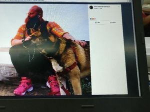 Nekat Suntik Mr P dengan Silikon, Seorang Pria Australia Tewas
