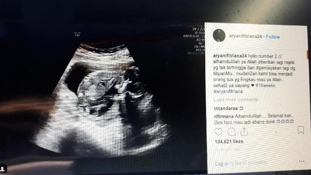 Selamat! Aryani Fitriana Hamil Anak Kedua
