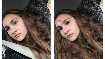 Netizen minta seatbelt dihilangkan, alhasil jidatnya dibuat benjol.  Foto: James Fridman