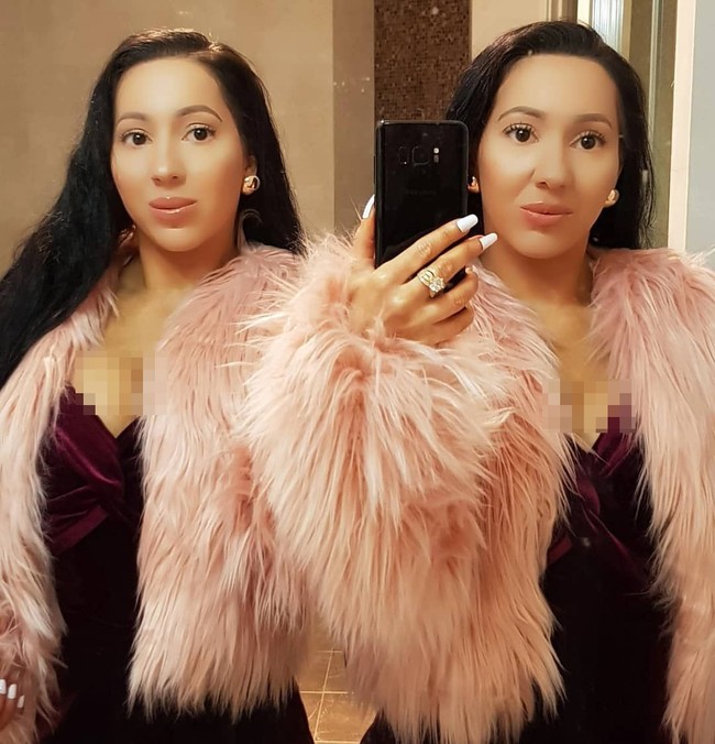 Si kembar telah mencari pengobatan untuk dysmorphia tubuh mereka, dan sekarang meminum antidepresan. Mereka juga mengambil langkah-langkah untuk mengembalikan penampilan asli mereka. Meskipun mereka enggan untuk kembali ke bawah pisau bedah, Anna dan Lucy tetap mempertahankan rezim perawatan kulit ketat mereka yang meliputi masker wajah, masker kaki, lulur tubuh. Foto: Instagram @annalucydecinque