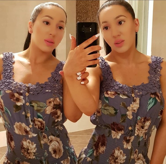 Tak satu pun dari si kembar senang tentang pilihan operasi plastik mereka. Kami malu dengan apa yang kami lakukan pada diri kami sendiri, tetapi kami memilikinya dan harus menerimanya, ujar Lucy. Foto: Instagram @annalucydecinque