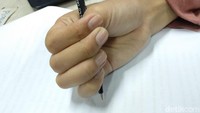 Saat jari-jari menutup ibu jari saat memegang pulpen atau pensil, itu menandakan kamu memiliki pesona yang luar biasa sehingga tanpa sadar menarik perhatian orang sekitarmu.  Foto: Widiya Wiyanti/detikHealth