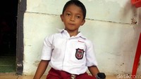 Muklis Abdul Kholik (9) terlihat ceria menggunakan seragam sekolah miliknya, bocah yang akrab disapa Adul ini memiliki keterbatasan fisik pada kedua kakinya. Meskipun begitu, semangat Adul untuk tetap pergi ke sekolah patut diacungi jempol.