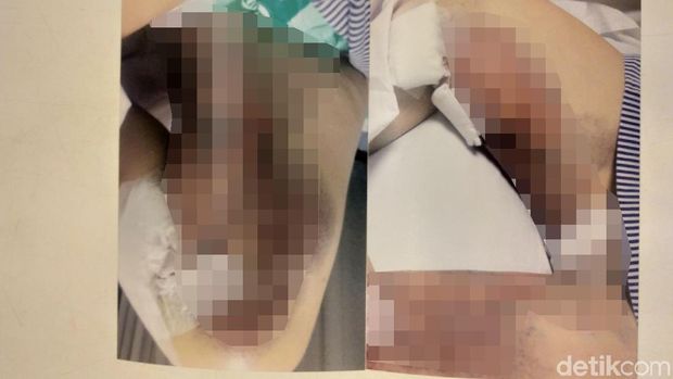 Merasa dirugikan, Irene melapor ke Polda Metro Jaya.