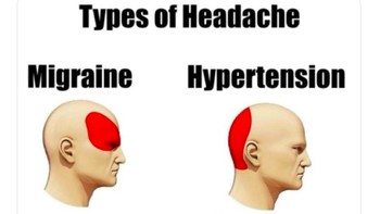 Tipe-tipe sakit kepala, menjadi fans MU paling parah tipenya. Foto: Twitter