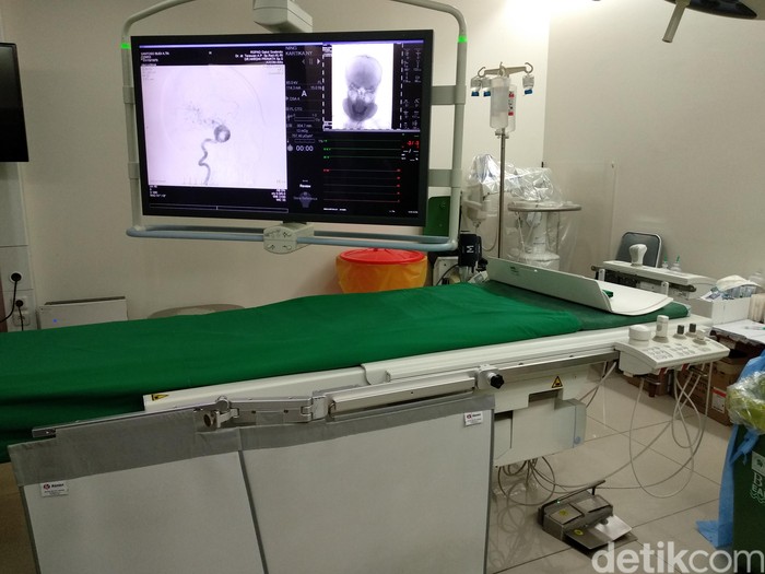 Digital Substraction Angiography cuci otak dr terawan Digital Substraction Angiography cuci otak dr terawan