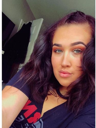 Ngeri! Tangan Wanita Ini Terbakar Saat Lakukan Manikur di Rumah 