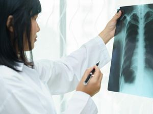 Mengenal Pneumonia: Gejala, Penyebab, dan Pencegahannya