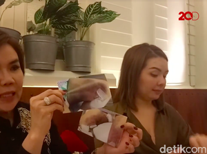 Perdarahan Usai Sedot Lemak, Irene Menduga Ada Malapraktik
