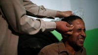 Omar pun memulai terapi alternatif menggunakan racun sengatan lebah. Menurut pria berumur 30 tahun itu, racun lebah tak hanya mampu membantu menyembuhkan penyakit tetapi juga bermanfaat untuk meningkatkan suasana hati seseorang.