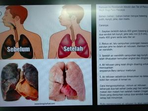 Viral! Ramuan Pembersih Paru-paru bagi Perokok, Benar Bisa Nggak Sih?