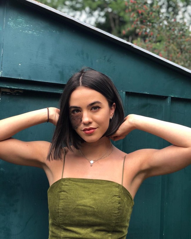 Orang-orang sering mendatangiku dan menanyakannya. Aku tidak menghindar dari pertanyaan-pertanyaan itu. Wajar kalau penasaran. Tanda lahirku tertutupi rambut jadi sulit disembunyikan tapi sejujurnya aku tidak masalah. Aku tahu banyak orang merasa kasihan, tapi aku percaya diri dengan penampilanku, tambahnya. Foto: Instagram/@cassandranaud