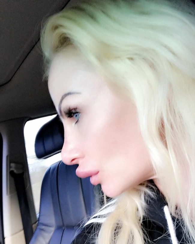 Padahal menurut Kelly, ia suntik filler di klinik yang bereputasi baik. Ia mengeluarkan biaya 250 Poundsterling atau sekitar Rp 4,6 juta. Foto: Instagram/@uk.barbie