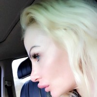 Padahal menurut Kelly, ia suntik filler di klinik yang bereputasi baik. Ia mengeluarkan biaya 250 Poundsterling atau sekitar Rp 4,6 juta. Foto: Instagram/@uk.barbie