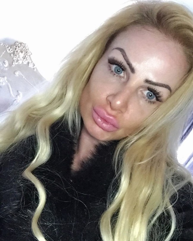 Aku tidak memperingatkan orang agar tidak suntik filler tapi lakukan survei terlebih dahulu. Kuharap yang lain bisa belajar dari kesalahanku, pungkasnya. Foto: Instagram/@uk.barbie