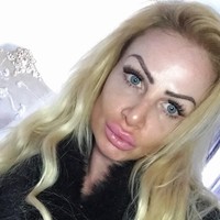 Aku tidak memperingatkan orang agar tidak suntik filler tapi lakukan survei terlebih dahulu. Kuharap yang lain bisa belajar dari kesalahanku, pungkasnya. Foto: Instagram/@uk.barbie