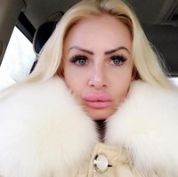 Aku tidak bisa keluar rumah selama berhari-hari karena sakit sekali dan aku terlihat mengerikan. Aku sempat komplain tapi dia bilang aku hanya kurang minum dan bibirku cuma perlu dipijat-pijat sampai mendapatkan bentuk yang diinginkan, cerita Kerry. Foto: Instagram/@uk.barbie