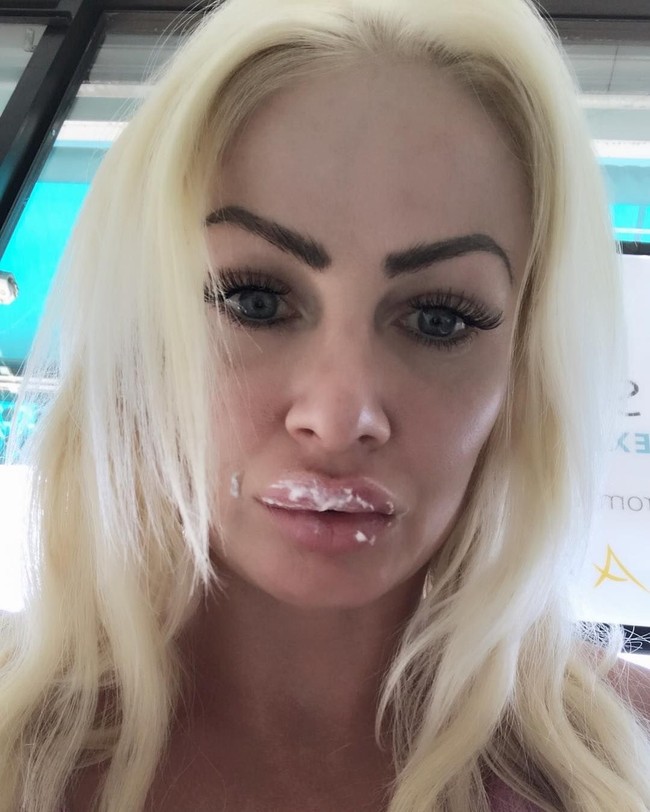 Wanita asal Essex, Inggris, ini suntik filler untuk mempercantik senyumannya. Tapi setelah prosedur selesai dilakukan, bibirnya terlihat seperti daging mentah saking besar dan tebalnya. Foto: Instagram/@uk.barbie