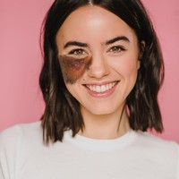 Bisa dilihat Cassandra memiliki tanda lahir berbulu cukup besar di wajahnya. Meski merupakan ketidaksempurnaan, hal tersebut justru membuatnya unik. Foto: Instagram/@cassandranaud