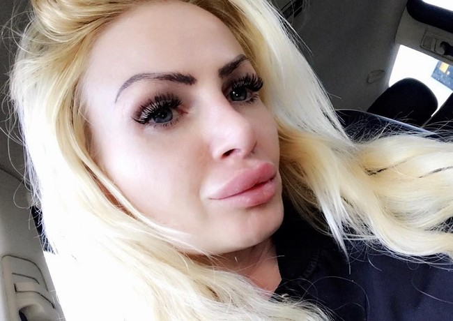 Aku datang ke klinik yang bereputasi tapi memang agak ragu ketika masuk ke dalam. Tempatnya terlihat kumuh dan kotor, bahkan ada anjing yang berkeliaran. Kelihatannya tidak higienis tapi aku ingin bibirku segera di-filler dan review kliniknya juga bagus, kata Kerry, seperti dikutip dari Daily Mail. Foto: Instagram/@uk.barbie