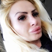 Aku datang ke klinik yang bereputasi tapi memang agak ragu ketika masuk ke dalam. Tempatnya terlihat kumuh dan kotor, bahkan ada anjing yang berkeliaran. Kelihatannya tidak higienis tapi aku ingin bibirku segera di-filler dan review kliniknya juga bagus, kata Kerry, seperti dikutip dari Daily Mail. Foto: Instagram/@uk.barbie