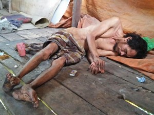 16 Tahun Dipasung, Warga NTB Itu Kini Lumpuh