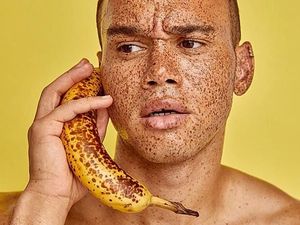 Penuh Bercak, Pria Ini Samakan Kulitnya dengan Kulit Pisang