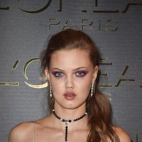 Industri fashion seolah jatuh cinta dengan Lindsey Wixson yang punya gigi renggang. Ia pun telah tampil untuk majalah Vogue dan berbagai brand eksklusif. Tapi sayangnya dulu Lindsey sempat tak punya teman dan diolok karena ciri khasnya itu. Foto: Getty Images