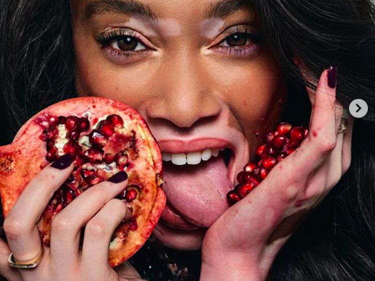 Ini Winnie Harlow, Model Berkulit Belang yang Doyan McD dan Popcorn