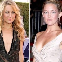 Dalam wawancara pada 2002, Kate Hudson mengaku bangga dengan payudaranya yang terbilang kecil. Aku punya dada yang sangat kecil. Itu sangat menyenangkan ketika menggunakan baju dengan belahan dada rendah karena terlihat elegan, ungkapnya di acara Golden Globes 2002. Kini, payudara bintang film Something Borrowed itu terlihat lebih berisi. Bisa dilihat dalam foto ini. Di awal kemunculannya, Kate memiliki dada yang terbilang rata. Sementara foto terbarunya, Kate tampak lebih seksi dengan bentuk dada yang lebih besar. Foto: Istimewa