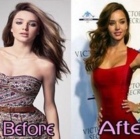 Dalam foto ini, jelas terlihat payudara Miranda Kerr dulu dan sekarang. Tidak disangka, mantan model lingerie Victorias Secret itu juga melakukan pemasangan implan payudara, meski ia tidak pernah membahasnya sama sekali. Foto: Istimewa