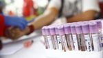 Momen Peringatan Hari AIDS Sedunia di CFD Jakarta