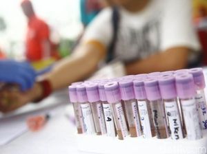 Hari AIDS Sedunia, Kenali Gejala HIV-AIDS pada Wanita