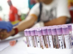 Kenapa Pasien London dan Pasien Berlin Bisa Sembuh dari Infeksi HIV?