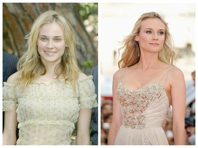 Bintang lainnya yang diduga melakukan implan payudara adalah aktris Diane Kruger. Pembesaran payudaranya terlihat alami dan tidak berlebihan, sehingga bintang film Inglourious Basterds itu jauh dari gosip miring tentang implannya. Foto: Istimewa