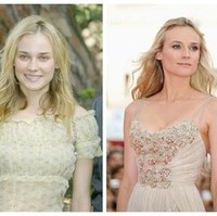 Bintang lainnya yang diduga melakukan implan payudara adalah aktris Diane Kruger. Pembesaran payudaranya terlihat alami dan tidak berlebihan, sehingga bintang film Inglourious Basterds itu jauh dari gosip miring tentang implannya. Foto: Istimewa